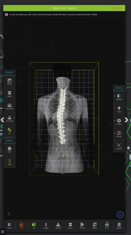 Σύστημα Ψηφιακής Αξιολόγησης Τρισδιάστασης Στάσης Σώματος Spine 3D Sensor Medica