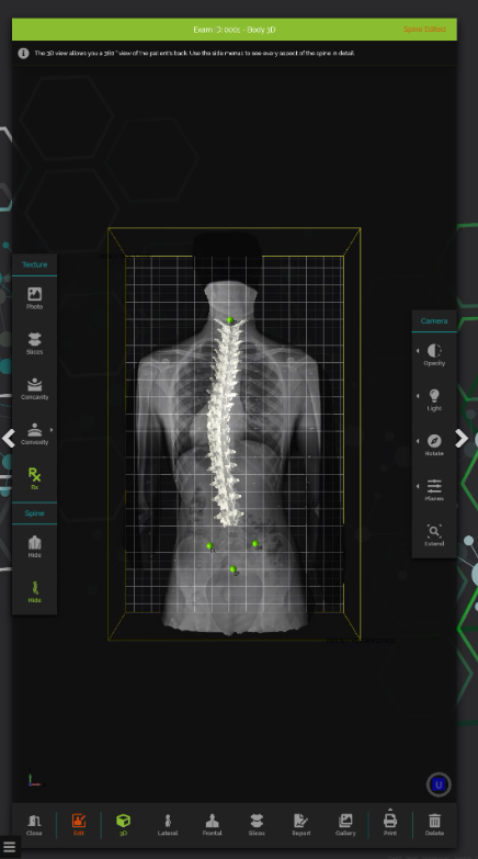 Digital Posture 3D Evaluation System Spine 3D Sensor Medica