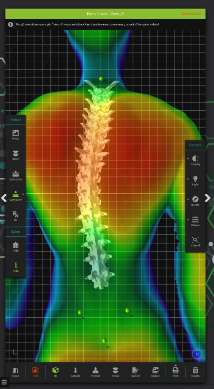 Σύστημα Ψηφιακής Αξιολόγησης Τρισδιάστασης Στάσης Σώματος Spine 3D Sensor Medica
