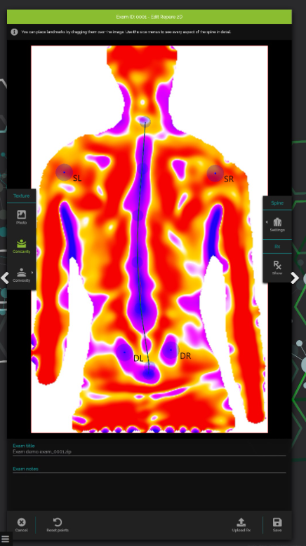 Digital Posture 3D Evaluation System Spine 3D Sensor Medica