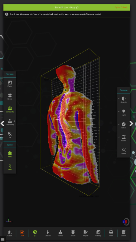 Digital Posture 3D Evaluation System Spine 3D Sensor Medica