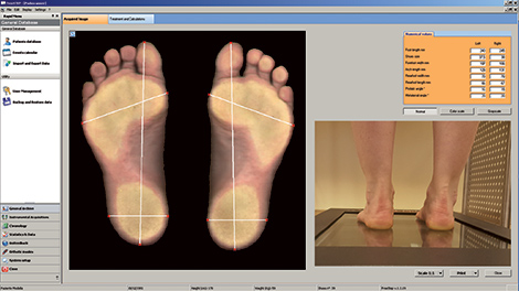 Σκάνερ Ψηφιακής Μέτρησης Podoscan 2D Sensor Medica